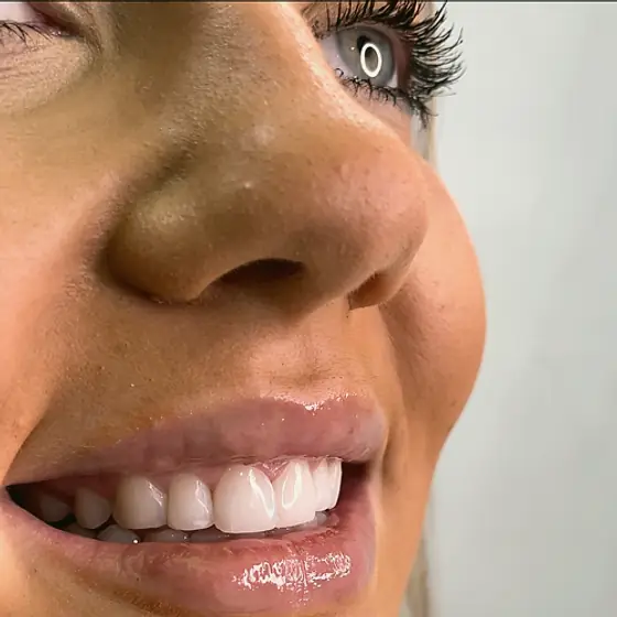 Close-up of a smile treated at Park Place Dental