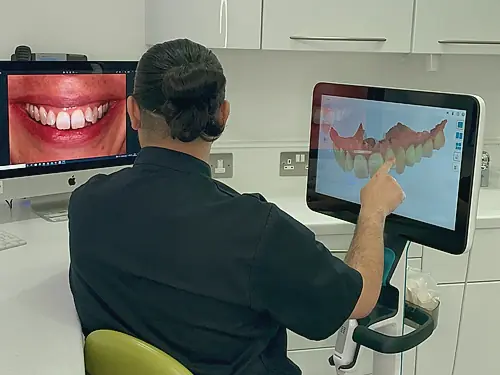 A clinician planning an implant case on a 3D scanner