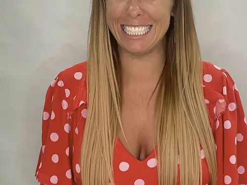 A Park Place patient smiling after a smile makeover